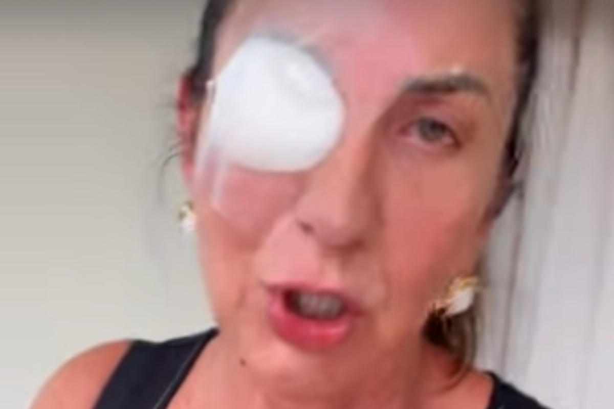 margareth serrão com olho enfaixado