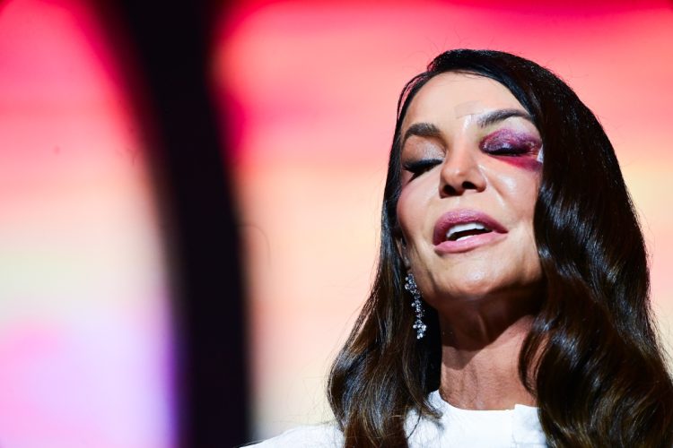 Ivete Sangalo canta exibindo hematomas no rosto