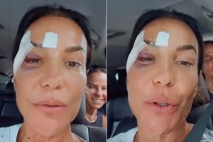 Ivete Sangalo recebe alta