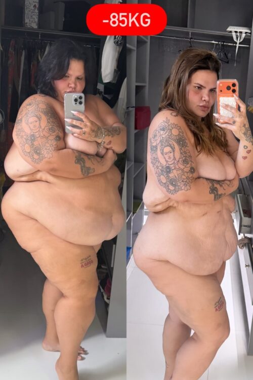 Thais Carla antes e depois