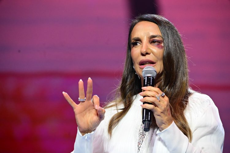 Ivete Sangalo com o olho roxo