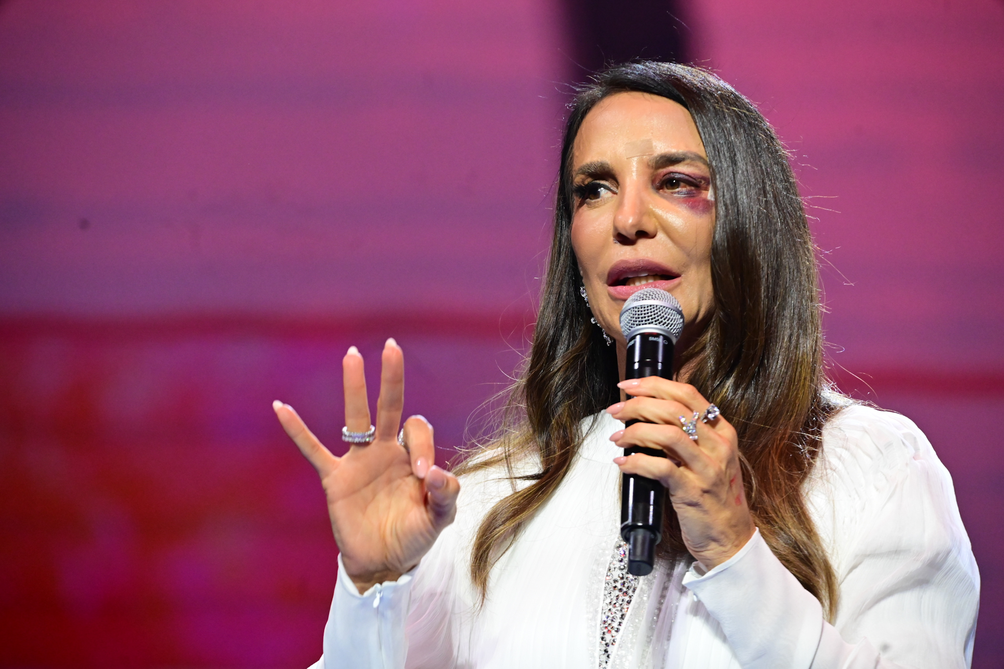 Ivete Sangalo com o olho roxo