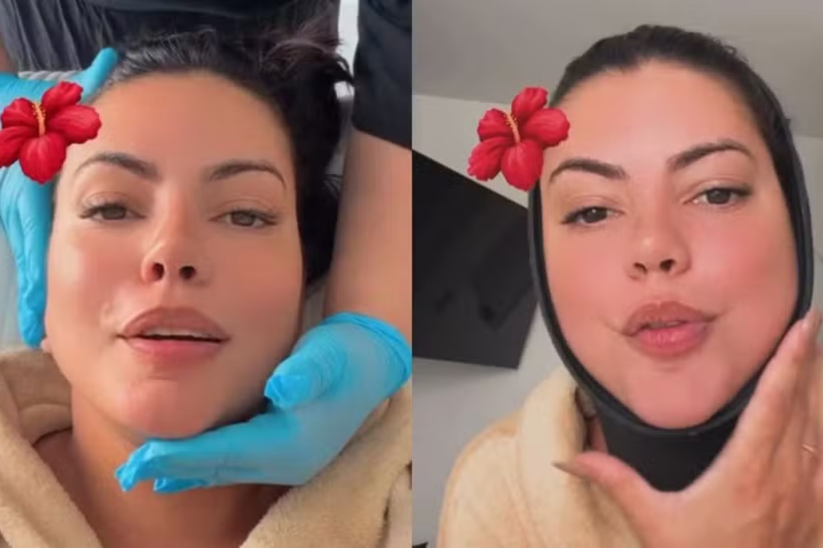 Fernanda Bande comenta o pós-operatório