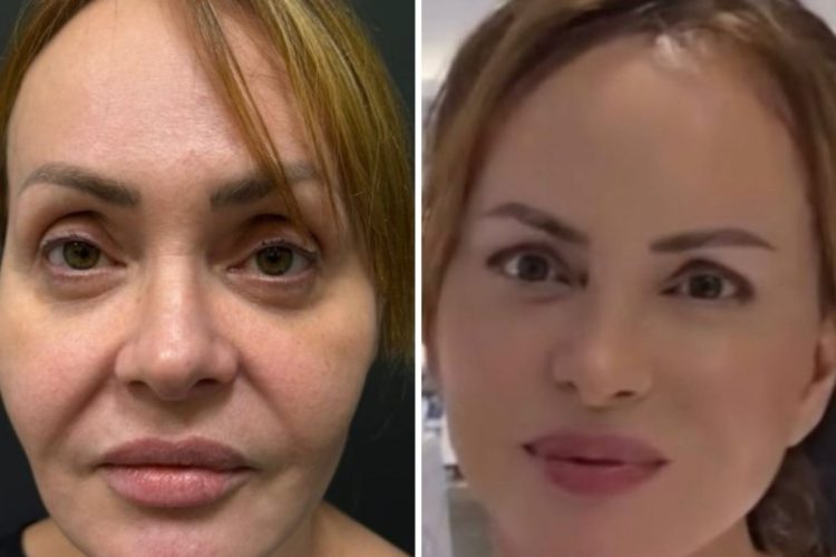 Gabriela Spanic antes e depois
