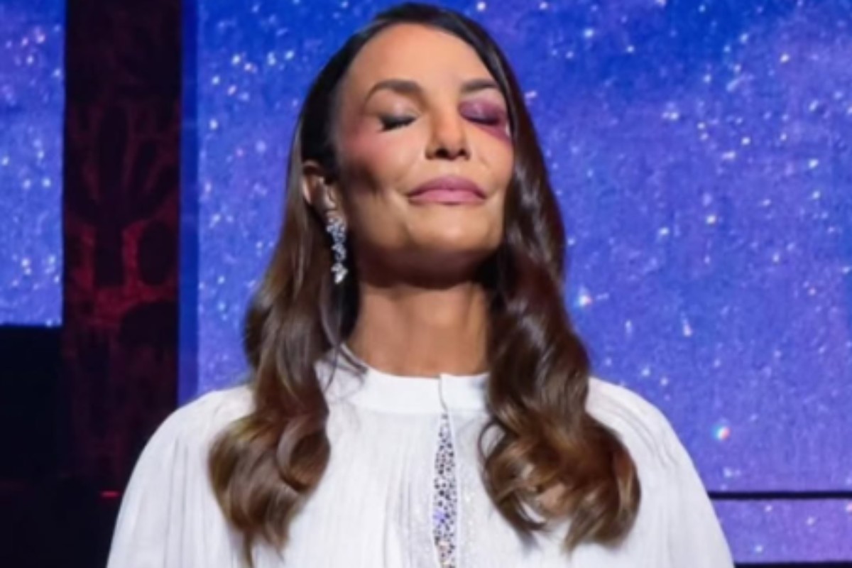 ivete sangalo com hematomas no rosto