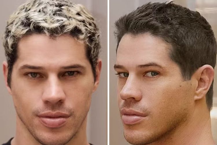 José Loreto antes e depois