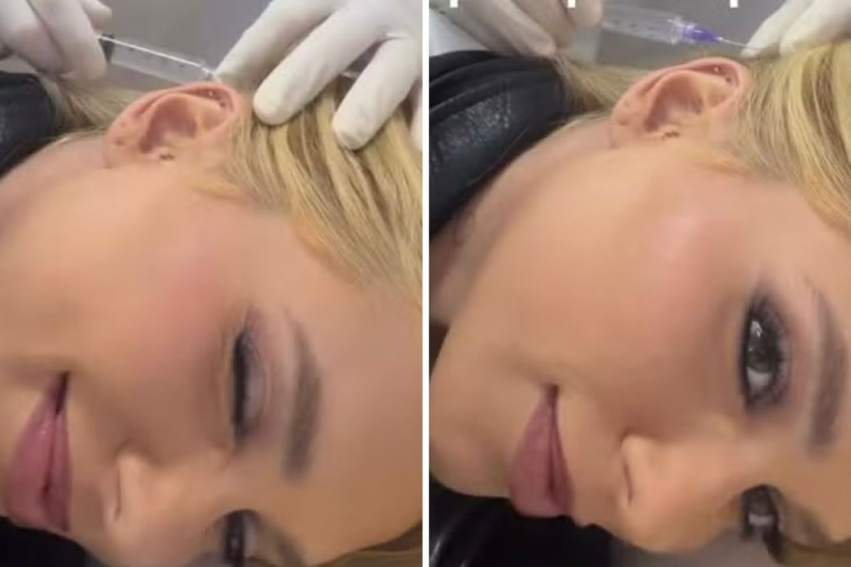 Virginia aplica botox