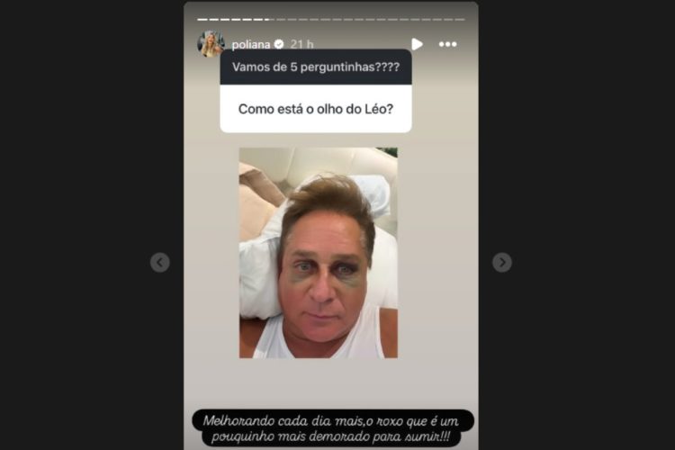 stories de poliana rocha atualziando estado do rosto de leonardo