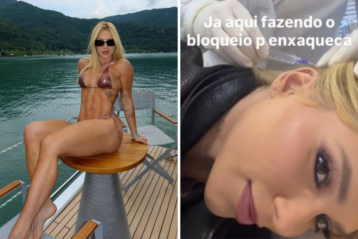 Virginia faz tratamento conta a enxaqueca