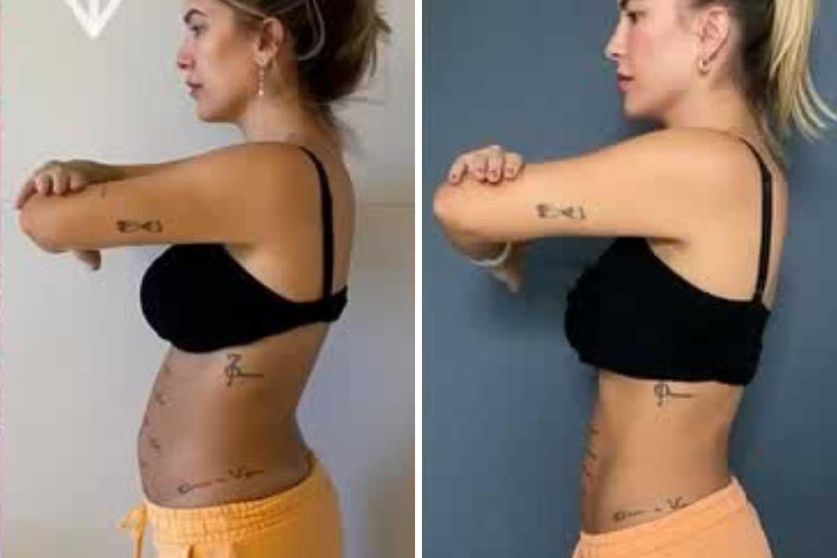 antes e depois da diástase de lore improta com levi
