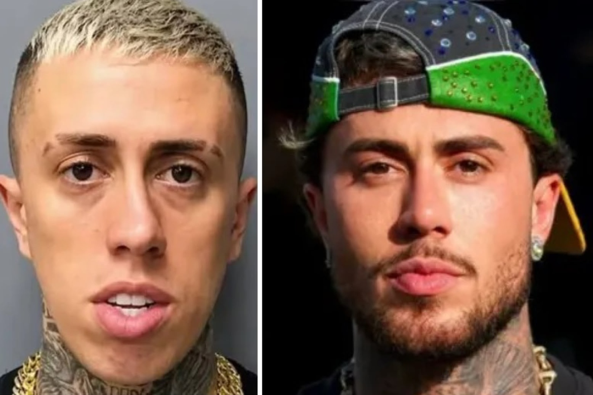 MC Daniel antes e depois da harmonização facial
